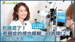 別搞混了！乾眼症的視力模糊和白內障不同 醫剖析差異｜蘆竹大學眼科 林岫儀醫師 #NOW健康 #乾眼症 #白內障