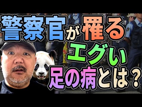 警察官が罹るエグすぎる足の病とは？【バスの運転手も罹る】【下手したらクビ？】