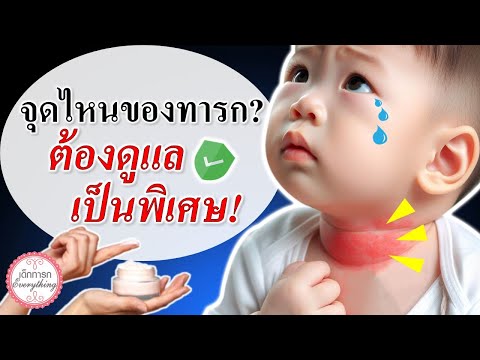 วิธีเลี้ยงเด็กทารก : จุดไหนในทารกต้องดูแลเป็นพิเศษ ?  | เลี้ยงทารก | เด็กทารก Everything