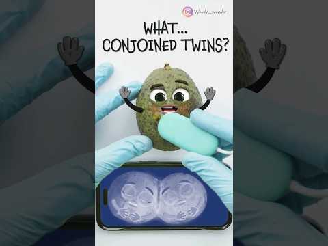 CONJOINED TWINS SKULLS ARE ONE😱🧠 - Avocado C-Section🥑 #fruitsurgery #foodsurgery #animation