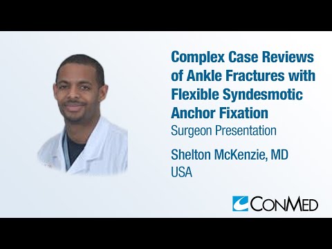 Dr. Shelton McKenzie - PRESENTATION(2023): Ankle Fractures with Flexible Syndesmotic Anchor Fixation