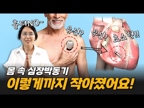 인공심장박동기의 모든 것 | 서울아산병원 차명진 교수