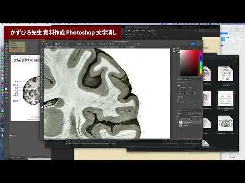 【かずひろ先生 資料作成 Photoshop】100年前の解剖書よりドイツ語を消してみた