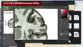 【かずひろ先生 資料作成 Photoshop】100年前の解剖書よりドイツ語を消してみた