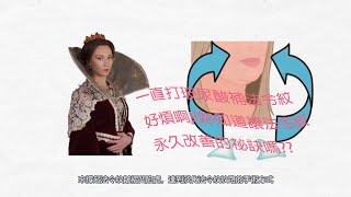 法令紋墊片貴族手術--一直打玻尿酸補法令紋好煩啊!!妳知道讓法令紋永久改善的祕訣嗎??