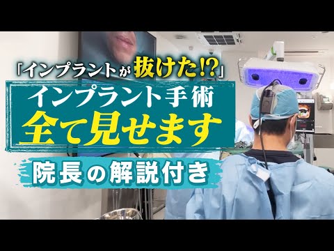 【初公開】インプラント失敗でやり直し！？再治療の手順すべてを見せます