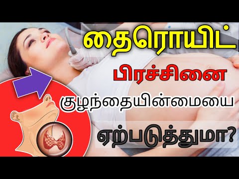 Thyroid symptoms in tamil/thyroid problem in tamil/thyroid problems in women tamil/TSH Test