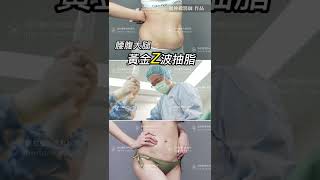 黃金Z波抽脂 / 腰腹大腿