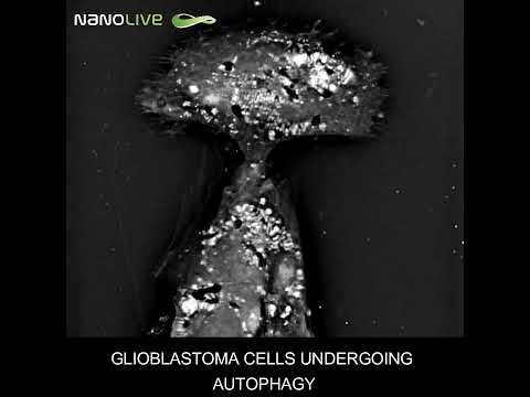 Label free live cell imaging glioblastoma cells undergoing autophagy #science #biotechnology