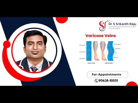 Varicose Veins | All you need to Know | Dr.Srikanth Raju | Vascular Surgeon | Hyderabad