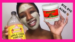 Aztec Secret Indian Healing Clay | Review + Demo