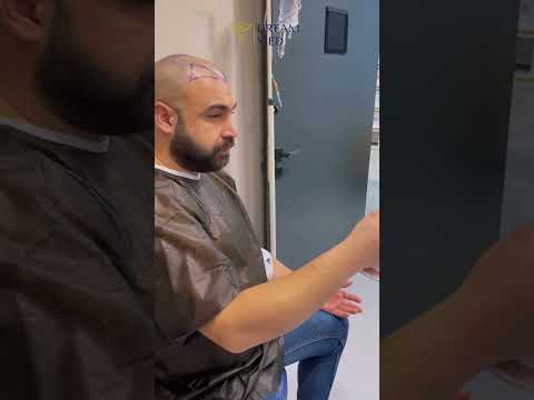 Saç Ekimi İşlemleri İçin Profesyonel Ekibimizle En İyi Hizmeti Sunuyoruz 💉#hairtransplant