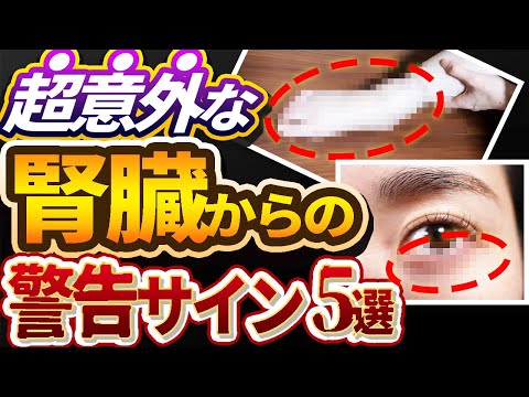 【放置厳禁】絶対見逃してはいけない腎臓が悪い時に出る症状について専門医が解説します。