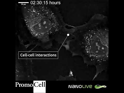 Protrusions in Human Umbilical Vein Endothelial Cells with Nanolive imaging