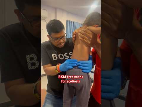 RKM treatment for Scoliosis #backpainrelief #drrajneeshkant