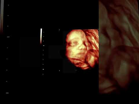 Baby Smiling During Ultrasound Will Make Your Heart Melt #amazing #baby #science #shorts