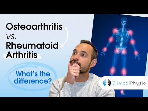 Osteoarthritis vs. Rheumatoid Arthritis | What's the Difference?