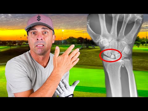 How can I Play Golf in the Good Good Tournament with a Broken Wrist?