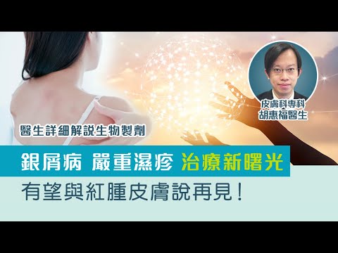 嚴重濕疹/銀屑病(牛皮癬)治療 | 生物製劑治療免疫系統疾病有效持久！皮膚科醫生講解生物製劑原理、成效、副作用及價錢