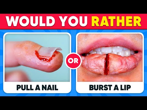 Would You Rather...? EXTREME Edition ⚠️😱 HARDEST Choices Ever!