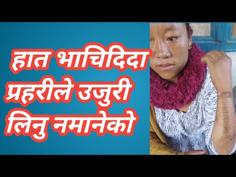 भोजपुरमा महिलाको  हात भचिदिदा प्रहरीले उजुरी लिनु मानेको थिएन, rajesh khimdung , #news