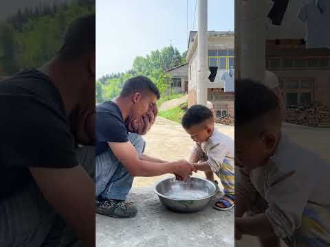 贵州血管瘤小伙28-year-old man with hemangioma in Guizhou Province, China