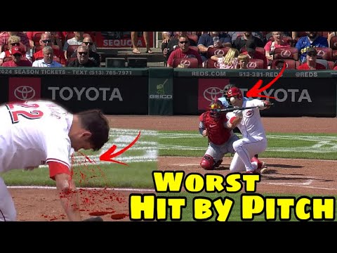 MLB | Worst Hit By Pitch May 2024