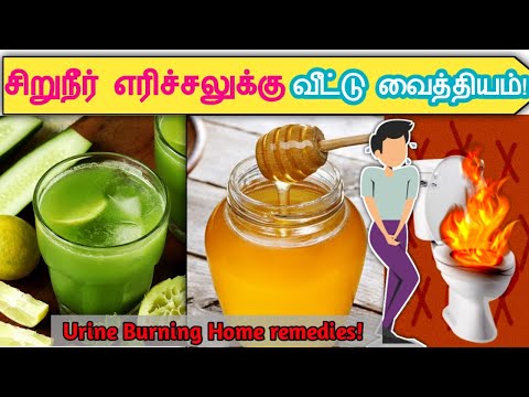 சிறுநீர் எரிச்சலுக்கு வீட்டு வைத்தியம்! | Urine burning home remedies in tamil | STAR LABORATORY