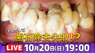 これって歯石除去失敗⁉️LIVE