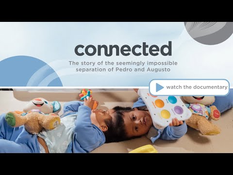 connected: the story of the seemingly impossible separation of conjoined twins, Pedro and Augusto