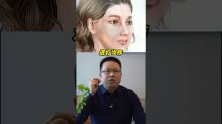 做无痕筋膜提升是无需拆线的！