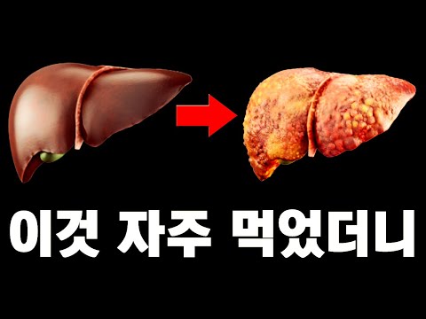 이것 자주 먹었더니 지방간에 걸렸다. 지방간 없애는 방법은 이것 먹지 않는 것