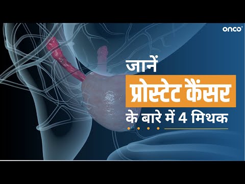 प्रोस्टेट कैंसर के बारे में 4 मिथक (Know 4 myths of Prostate cancer) | FAQ Hindi | Onco Cancer Care