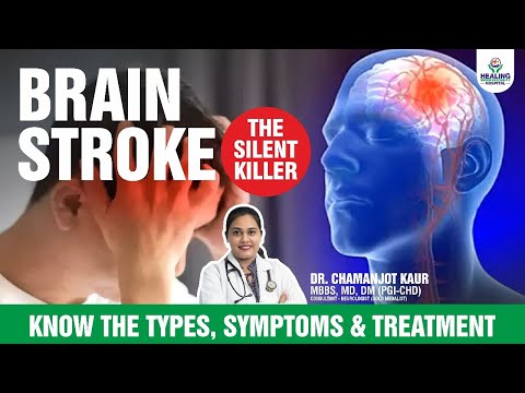 STROKE Signs You Should NEVER Ignore According to Dr Chamanjot Kaur