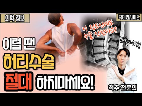 허리디스크 있을 때 수술을 하면 안되는 이유 – 허리디스크 있는 분들 꼭 보세요! [닥터인사이드]