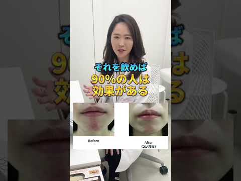 【女医に質問】ニキビの万能薬ありますか？#shorts