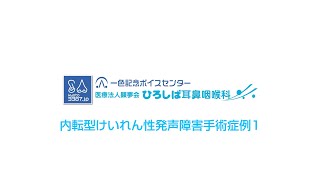 内転型けいれん性発声障害手術症例1