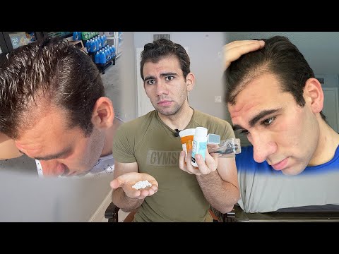 HOW I STOPPED MY HAIR LOSS!