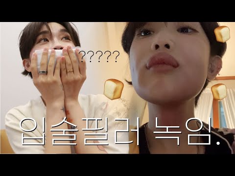 입술필러 싹 녹임. 그런데 이제 알러지를 곁들인^^🍞