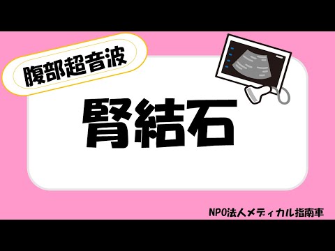 腎結石ー腹部超音波ー