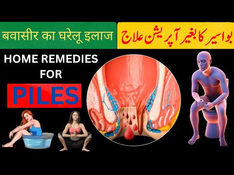 Piles Treatment at Home | Bavasir ka ilaj #piles #haemorrhoids #bavseer