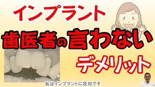 インプラント・歯医者の言わないデメリット