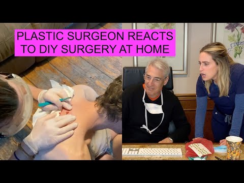 PLASTIC SURGEON REACTS to DIY CYST REMOVAL