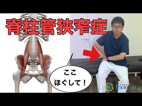 【3分健康講座】脊柱管狭窄症を楽にさせる腸腰筋アプローチ