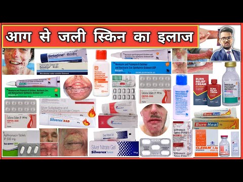 जली हुई स्किन की दवाईयां | Burn Skin Treatment | Creams for Skin | Pharmacy | Medicine | Treatment