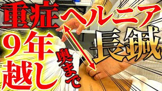 【ヘルニア　整体　超長い鍼】最悪の9年悩む腰痛、動かないガチガチの腰に史上最長30cmの鍼で鍼灸師に鍼灸師が治療。かなりヤバかった。【東京銀座　横浜元町　鍼灸】