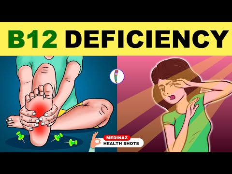 Vitamin B12 Deficiency Symptoms | B12 Deficiency | Vitamin B12 deficiency in 90 seconds