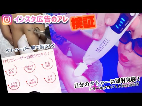 【ピコレーザーペン】自宅でシミ改善刺青除去ホクロ取りできるレーザー検証！【NEATCELL】