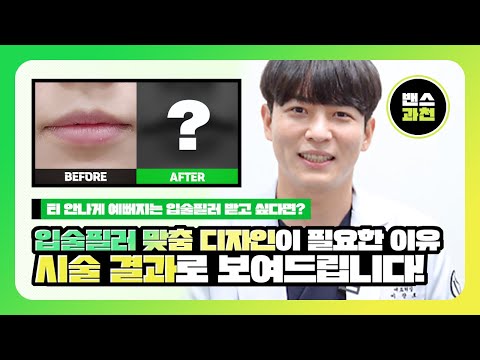 입술필러 맞춤 디자인이 필요한 이유? 결과로 보여드립니다!