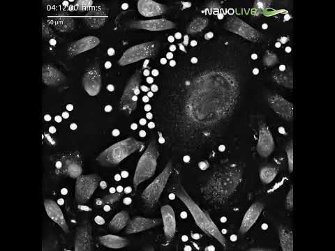 Holotomographic imaging of T cells and cancer cells in co-culture